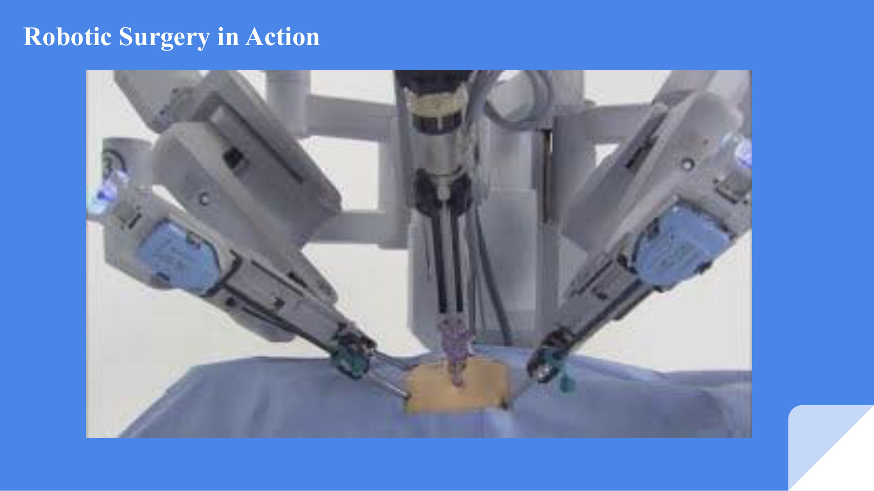Robotic surgery system in action